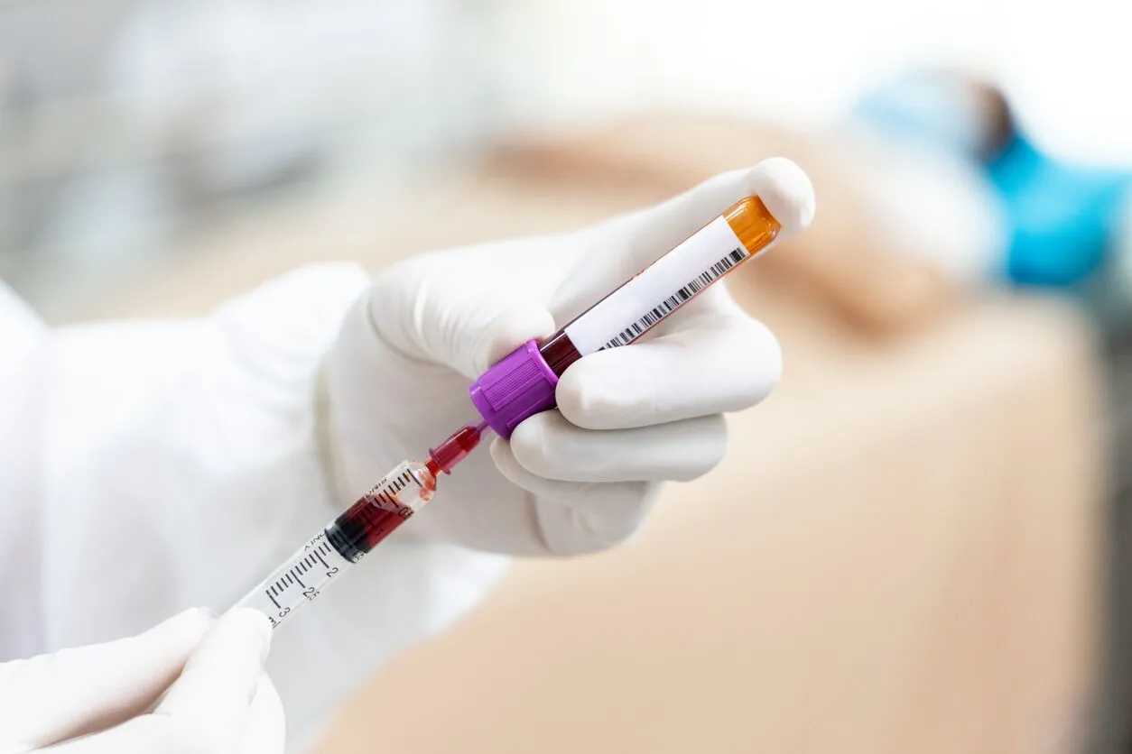 IVF 期间应何时进行卵巢复兴 PRP 治疗？