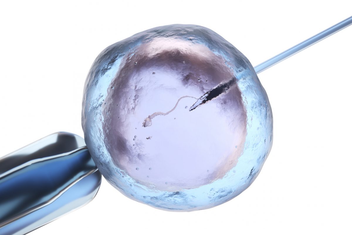 什么是 ICSI：胞浆内单精子注射指南