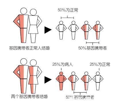 一文看懂地中海贫血的病因症状治疗预防