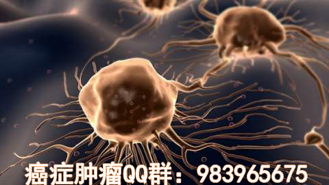 刚刚查出肿瘤，现在该怎么办？