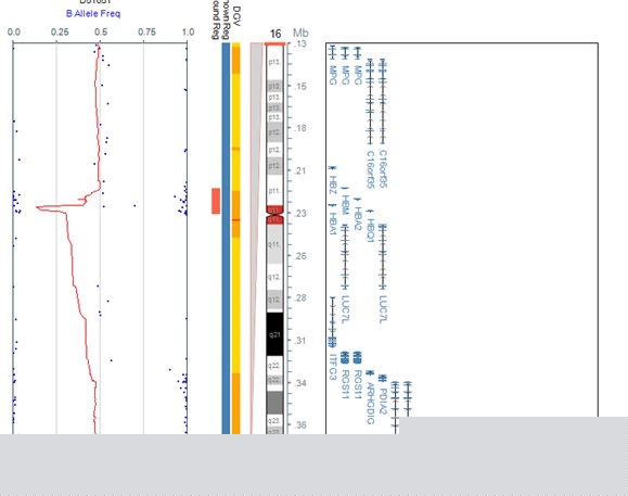 α地中海贫血顺利生育