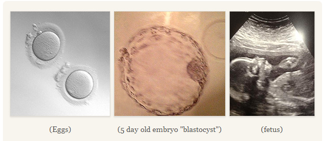 子宫内膜的厚度多少更有利于怀孕