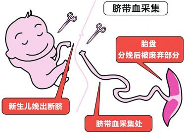 姐姐身患重型地贫成功移植妹妹脐血