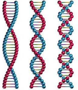 染色体异常遗传病 FOXG综合症 1