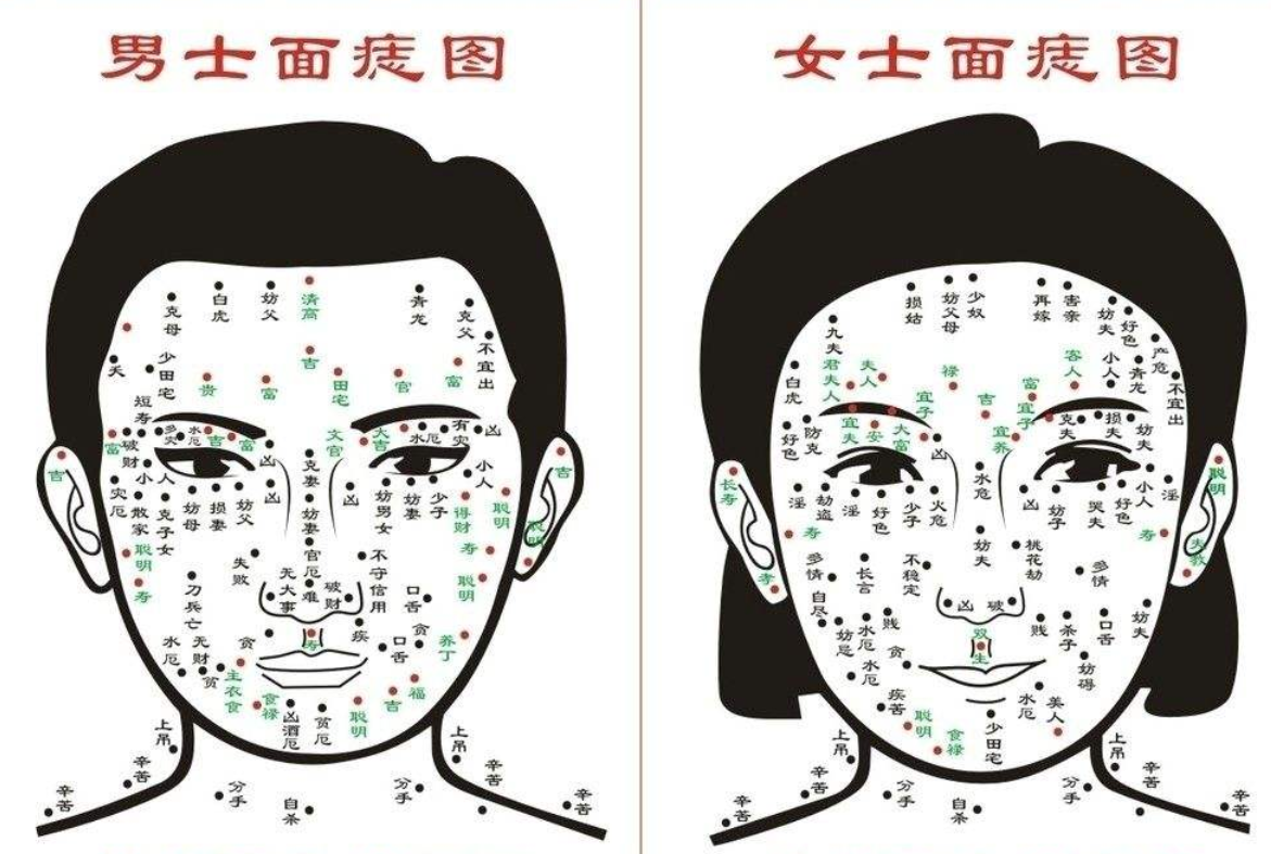 痣是由遗传决定的吗？