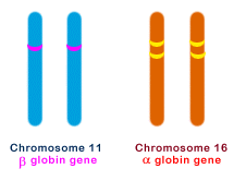 不同α（α）地中海贫血的基因类型
