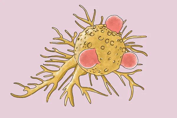 癌症会通过哪几个途径转移？癌细胞扩散时，身体有什么信号？