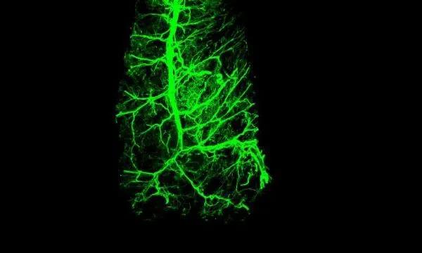 神经元可重塑体内脂肪控制其燃烧
