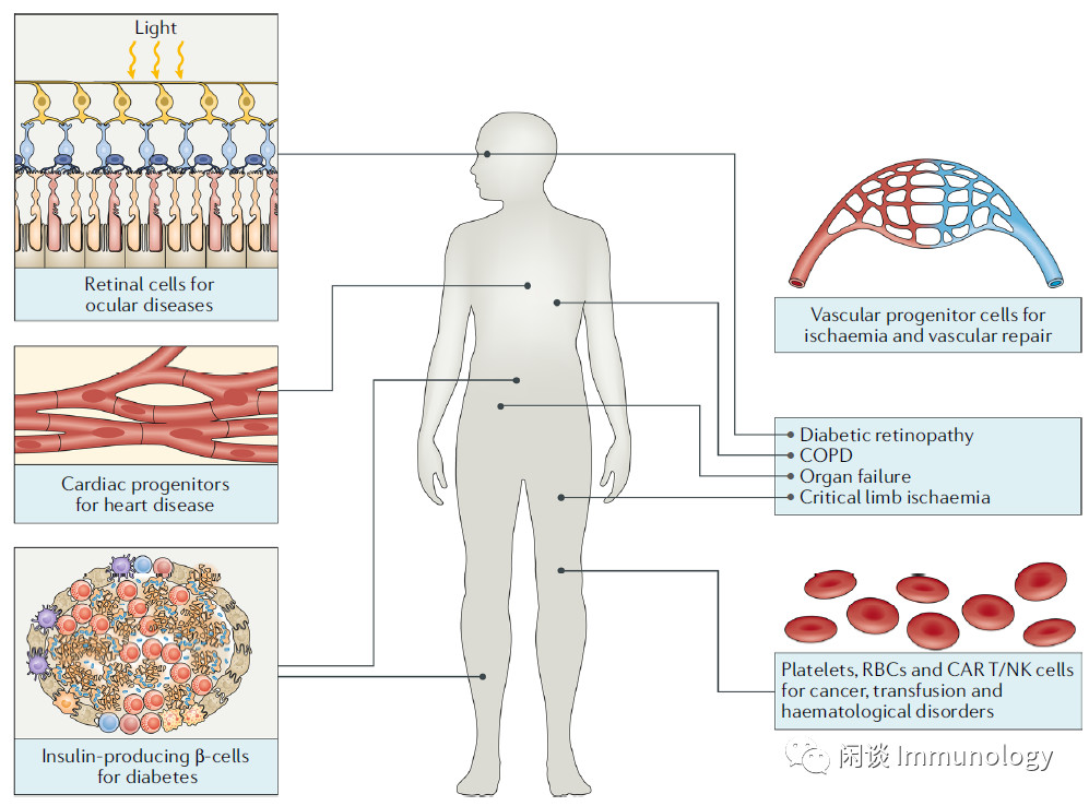 详解通用型细胞治疗