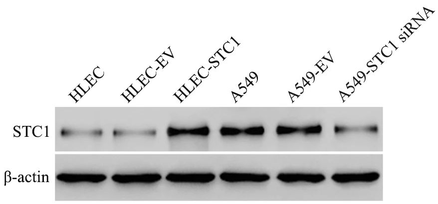 STC1诱导上皮-间质转化促进肺癌细胞的侵袭和迁移