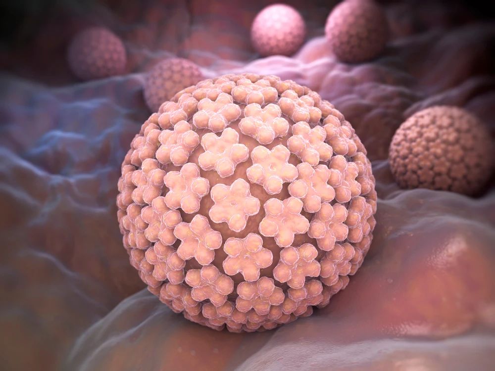 打了HPV疫苗 还可能患宫颈癌？