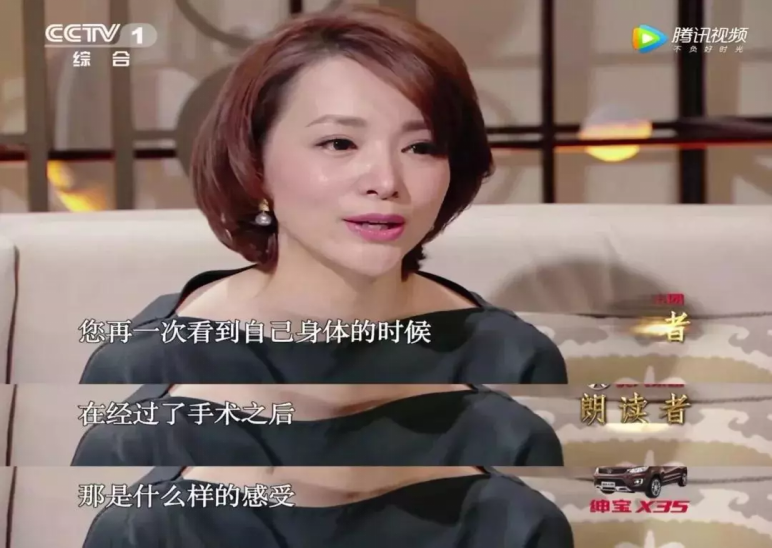 乳腺癌抗癌明星家敏老师