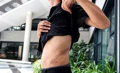 9年了，那个卖肾买苹果手机的17岁少年，现在怎么样了？