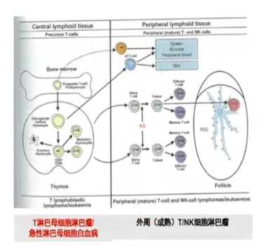 外周T细胞淋巴瘤NCCN指南解读
