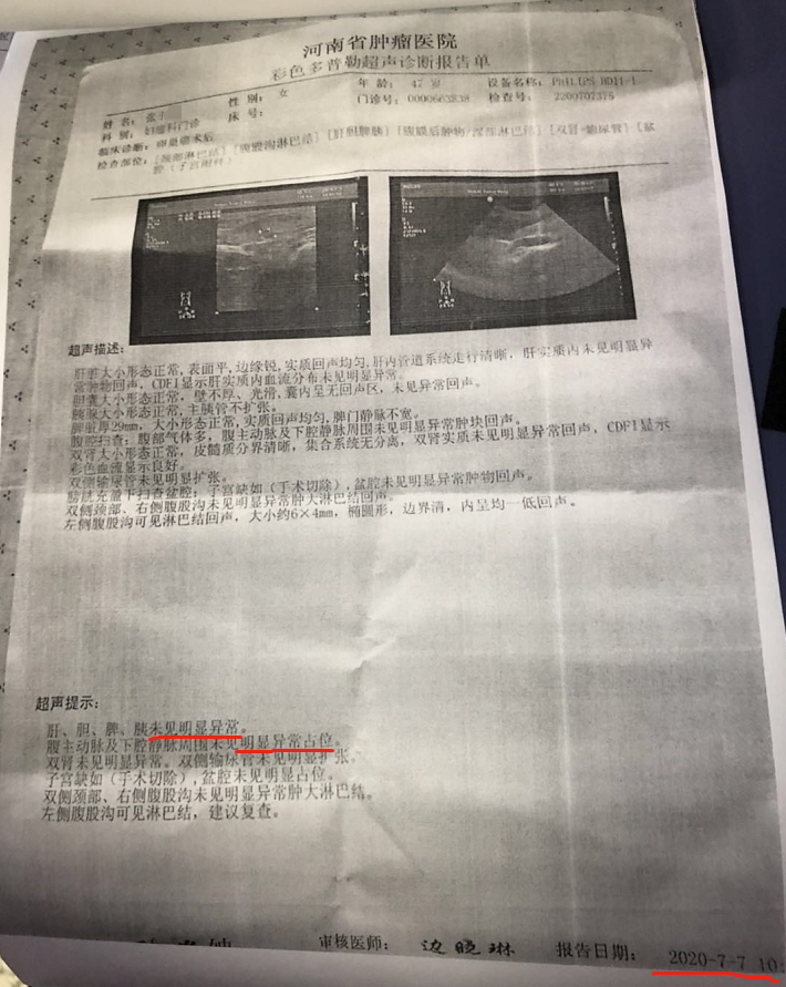 4年前，主治医生对她说：“ 生存期一年，最多也就两年 ”