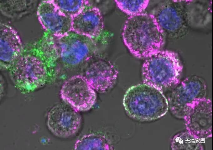 对实体瘤重磅出击！溶瘤病毒联手CAR-T细胞疗法，疗效势不可挡！