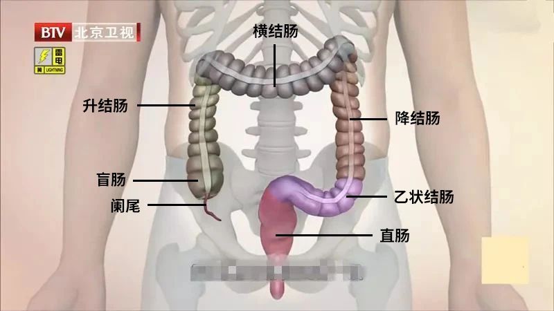 直肠癌在初期往往会被误诊为痔疮  耽误了最佳治疗时期！