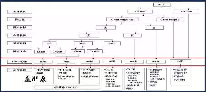 肝癌不同分期，该如何选择治疗方案？