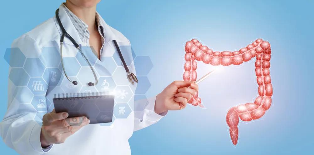 结直肠癌与微卫星不稳定（MSI）的10个临床问题