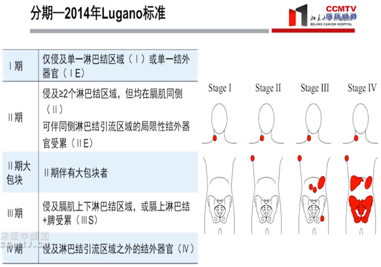 NCCN指南解读丨张晨教授：霍奇金淋巴瘤的诊治解读