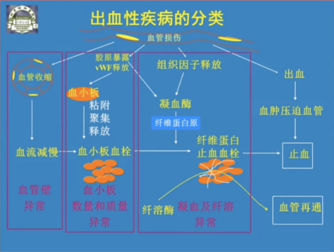  2020 赵永强教授称出血性疾病按这个思路走 诊断不再是问题！