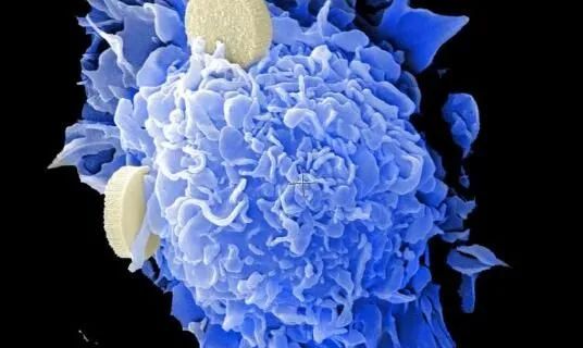 MMA积累或为年龄相关癌症发生的诱因