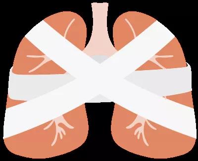 肺癌那些事儿：为什么手术能治疗肺癌？