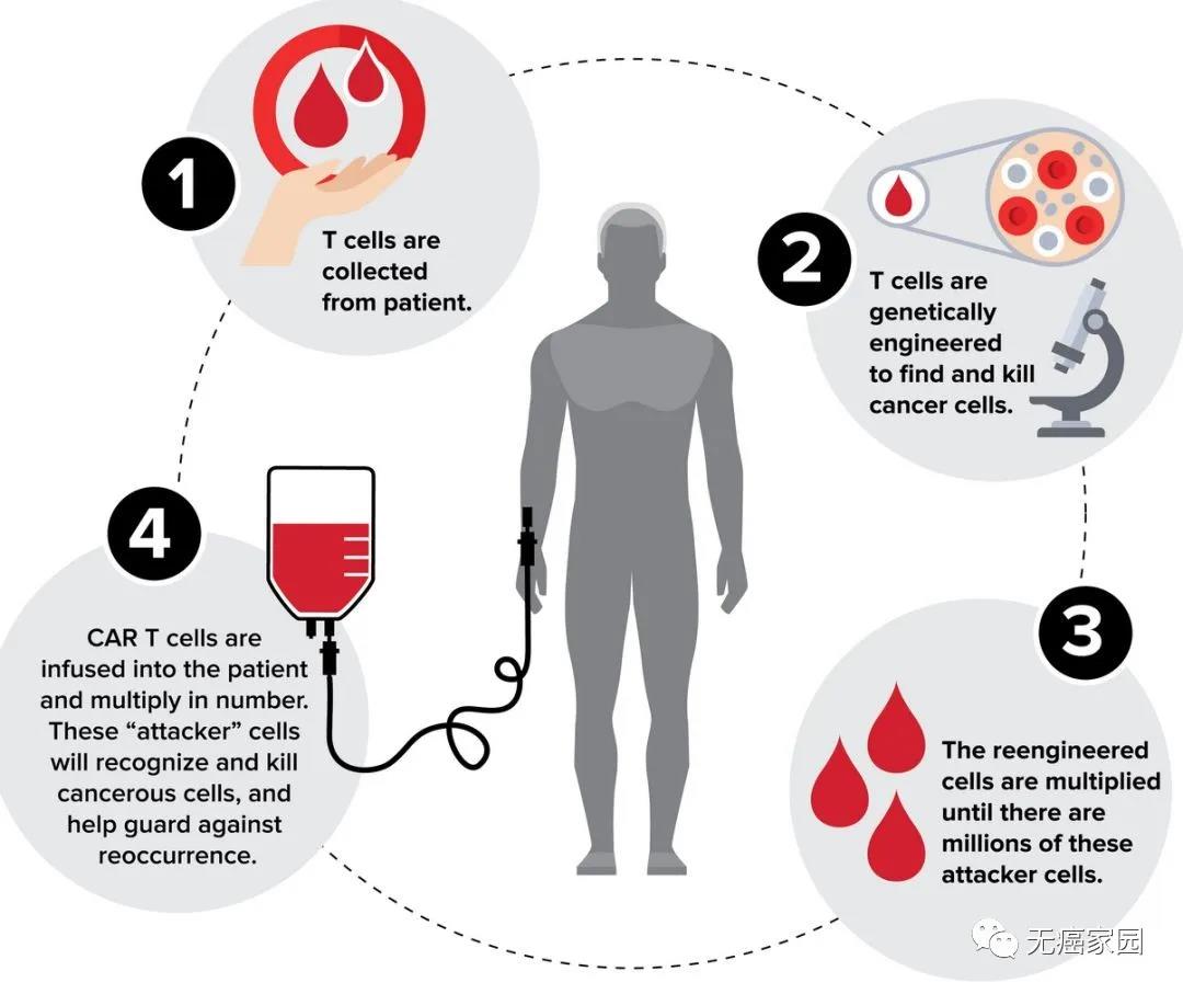 细胞疗法不再高冷 助力CAR-T疗法全面升级 让严重副作用消失殆尽