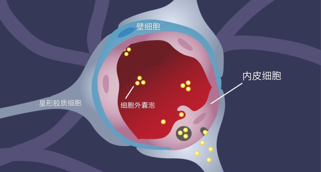 癌细胞“攻陷”大脑发生脑转移，未来该何去何从？