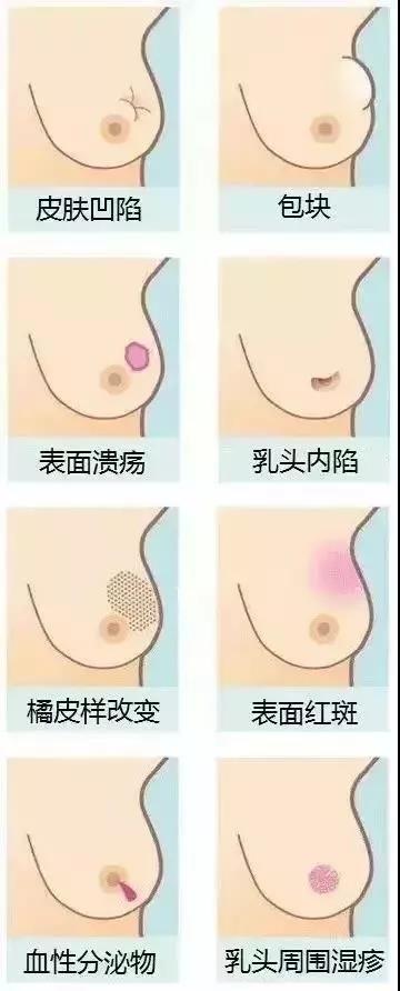 注意，乳腺癌更青睐这9类女性