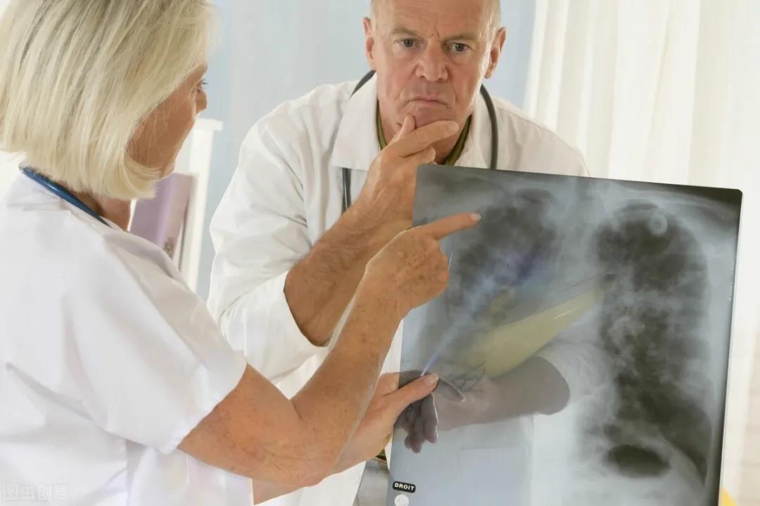 癌症转移会有什么症状表现？医生的答案来了