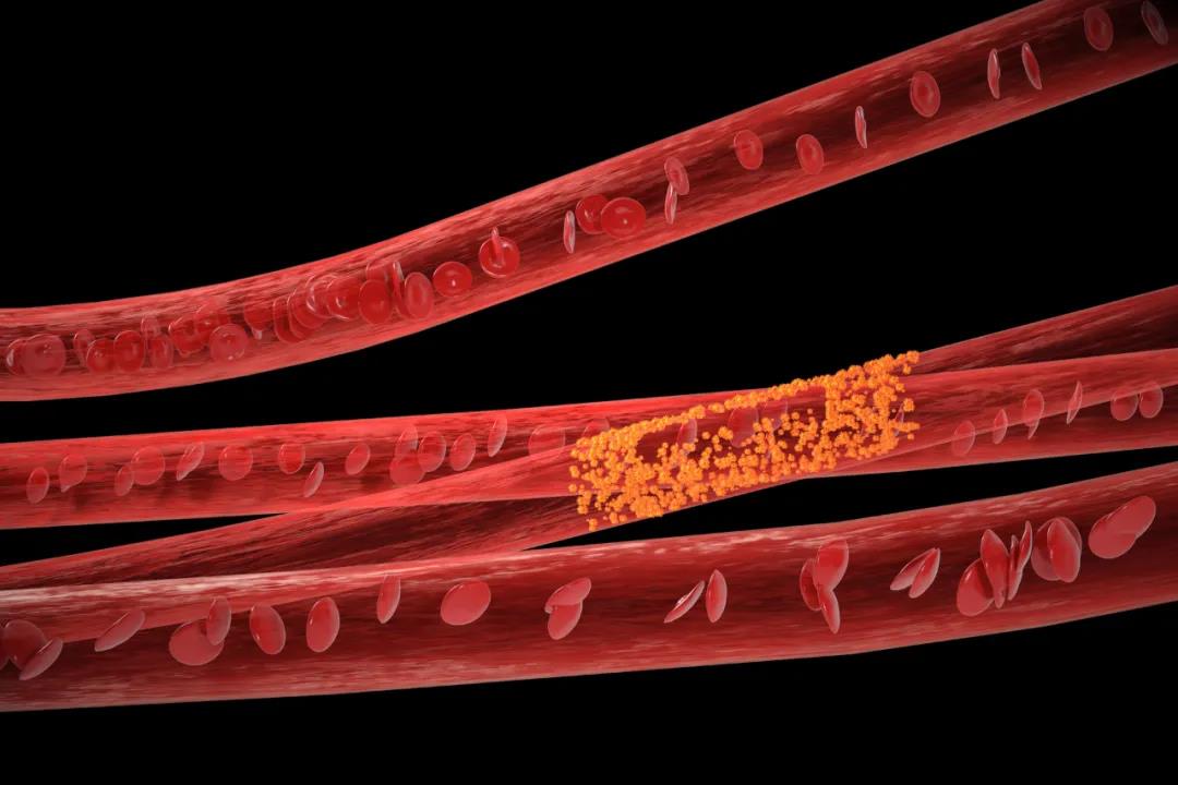 乳腺癌发生复发转移的预警信号，你不可不知！