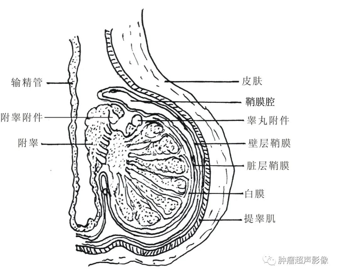 阴囊急症之急性睾丸附睾炎的超声诊断