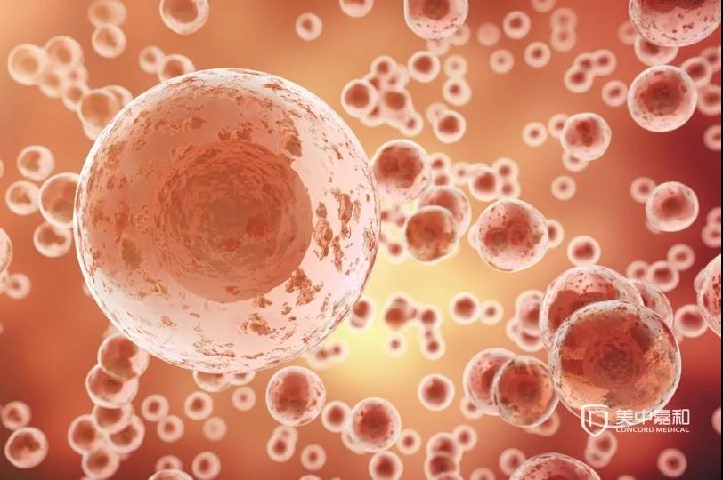 化疗是西医谋财害命的手段？接棒者”出现  节拍化疗来救你！