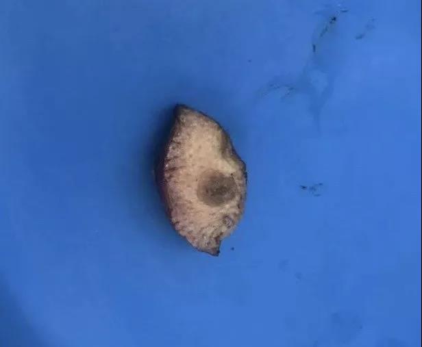 这种突然出现的皮肤表现，却可能提示恶性肿瘤？