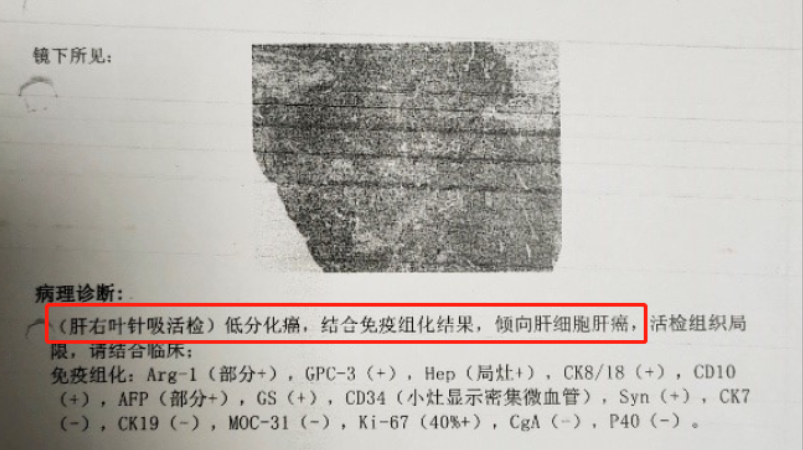 三代同堂的家里 有一老是有一宝