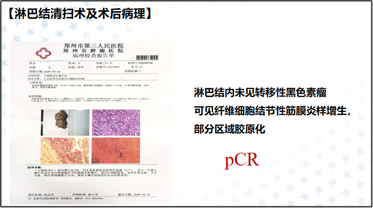 中国黑色素瘤诊疗进展与管理经验