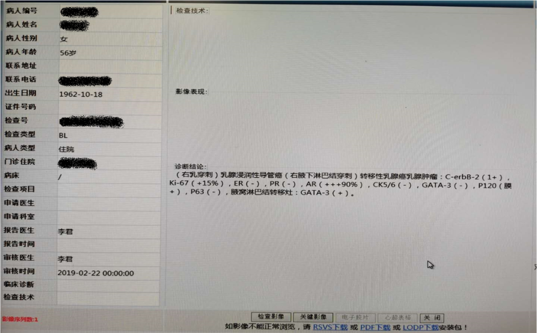 口服长春瑞滨胶囊治疗乳腺癌经验分享
