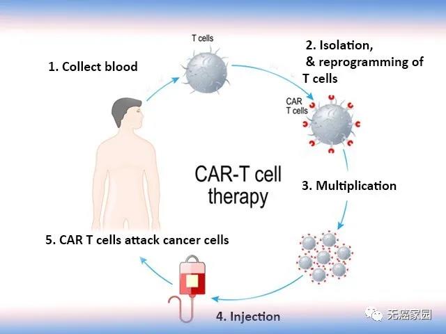 5年后60%患者仍处于缓解期！CAR-T细胞疗法长期疗效再创奇迹！