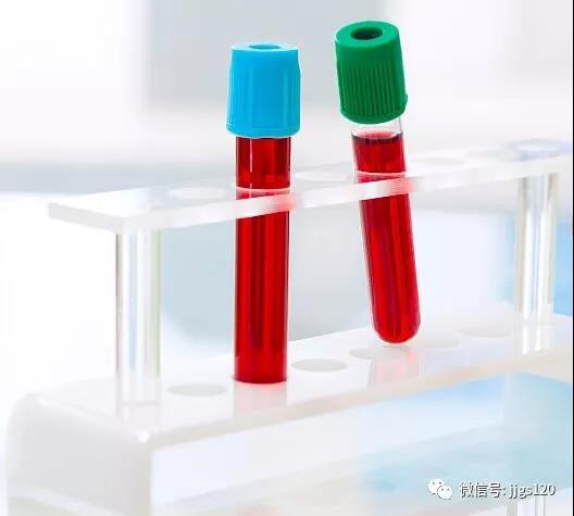 多发性骨髓瘤治疗理念加强：强调个体化方案！