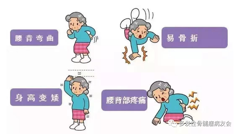 多发性骨髓瘤“骨质异常疏松”怎么办？