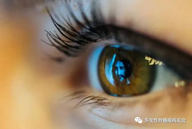 多发性骨髓瘤眼睛突然模糊是怎么回事？