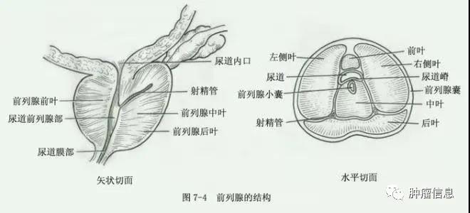 前列腺癌解剖分区及MRI表现