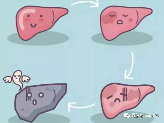 慢性骨髓纤维化是不是发展的特别慢？