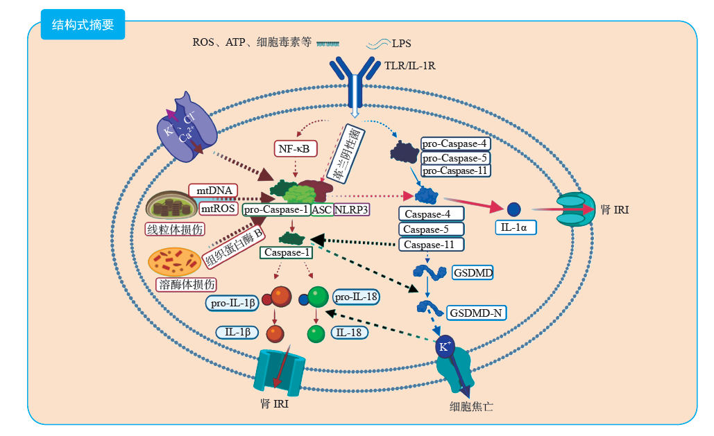 NLRP3炎症小体与相关炎症信号通路在肾缺血-再灌注损伤中的作用