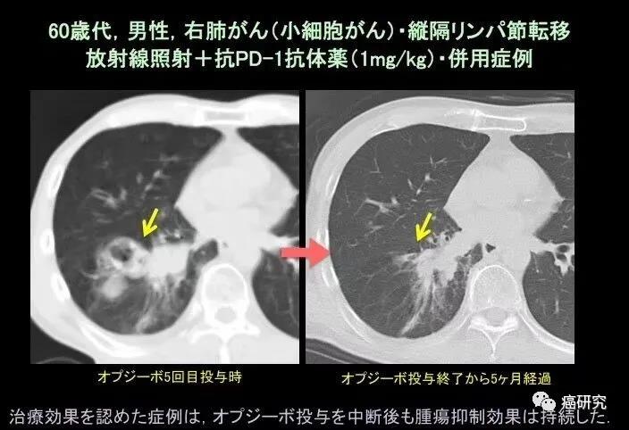 免疫治疗：低剂量给药与减少频率是否会影响疗效？