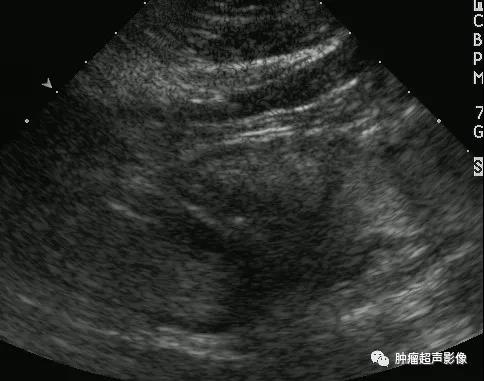 20210503162529.jpg 20210503162529.jpg