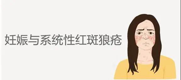 20210716212123.jpg 20210716212123.jpg