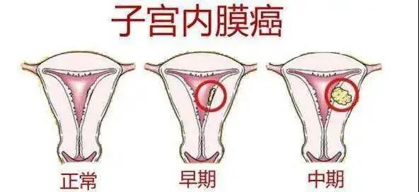 20210716211720.jpg 20210716211720.jpg