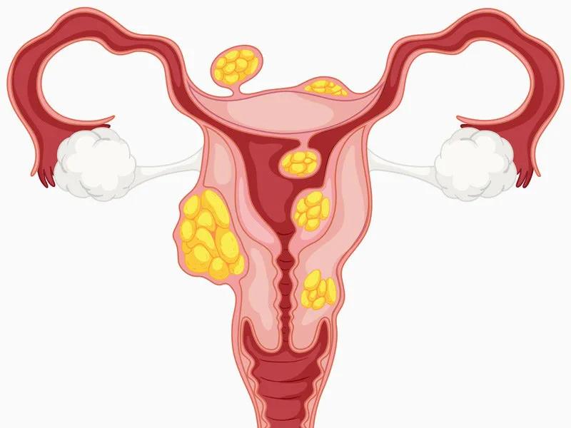 三代试管 三代试管